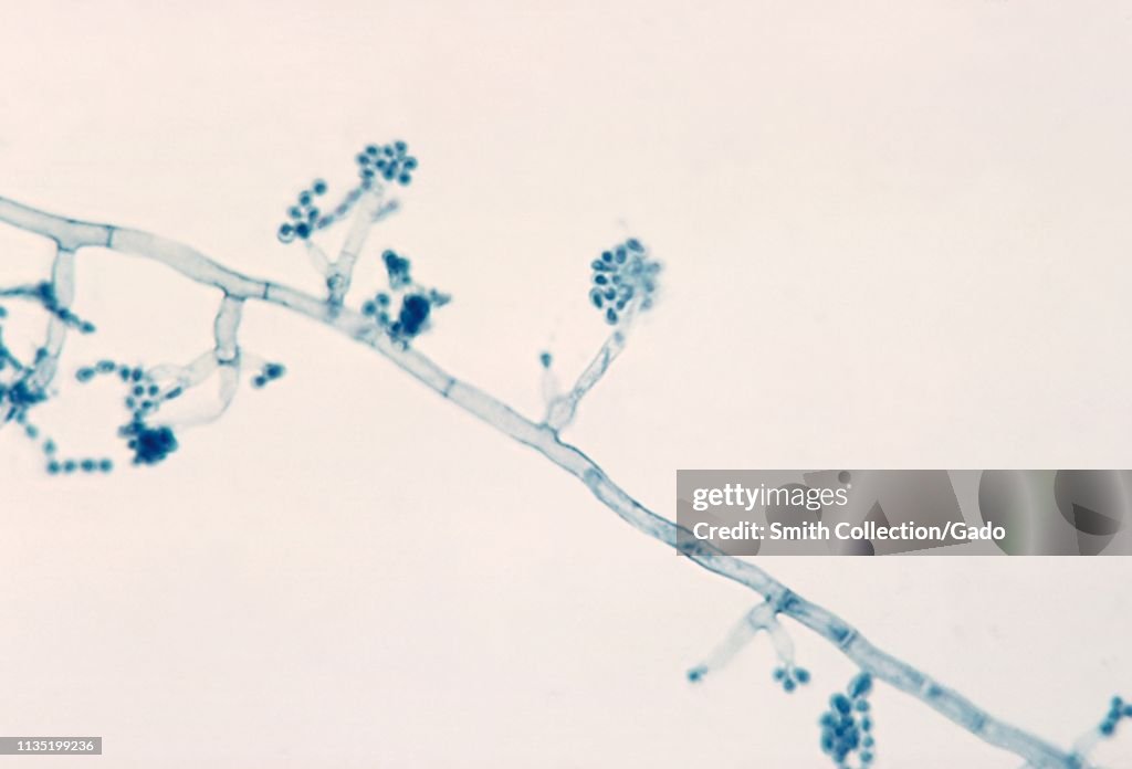 Madurella Mycetomatis