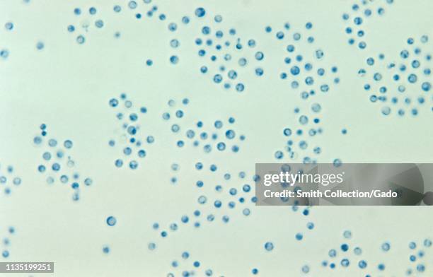 Criptococco 46 Cryptococcus Neoformans Stock Photos, High-Res Pictures, and Images ...
