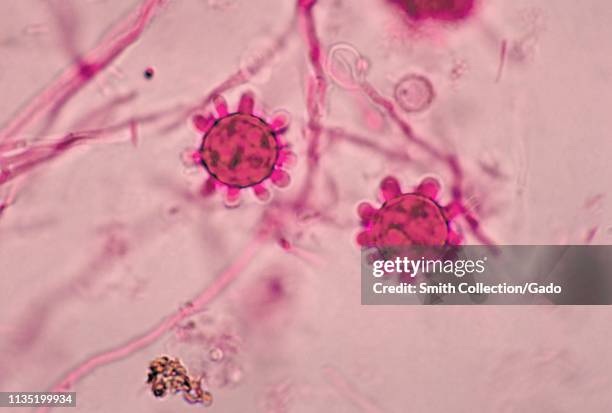 Photomicrograph of the Jamaican isolate tuberculate macroconidia of the dimorphic fungus Histoplasma capsulatum, 1968. Image courtesy Centers for...