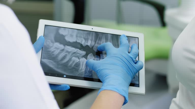 https://media.gettyimages.com/id/1135324859/video/dentist-looking-at-human-teeth-x-ray-on-the-digital-tablet.jpg?b=1&s=640x640&k=20&c=XG9awuYvPW7NcbK9Z45EBf8-s_t4ZmBoyKmKZCrui20=