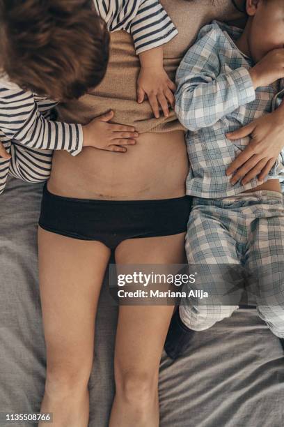 mother showing csection scar to her children - kaiserschnitt stock-fotos und bilder