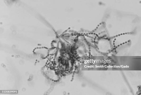 Penicillium Marneffei Penicillium Marneffei