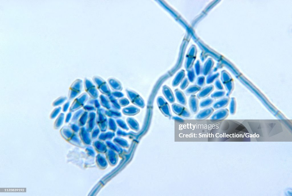 Cladosporium Werneckii