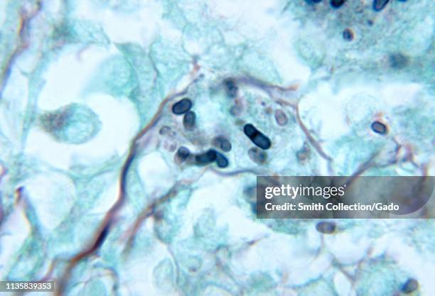 Methenamine silver stain photomicrograph of the histopathologic changes in a mouse testicle indicating penicilliosis caused by Penicillium marneffei,...