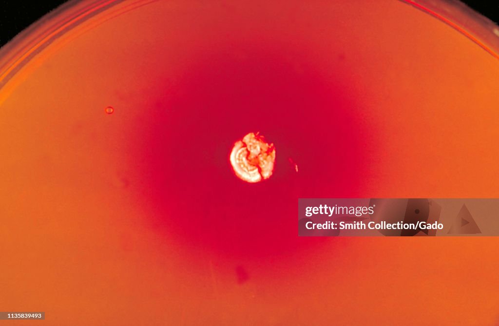 Close-up photograph of the Dermatophyte Test Medium agar plate... News ...