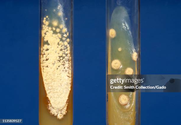 Close-up photograph of two slant cultures of the dimorphic fungus Histoplasma capsulatum colonies, 1979. Image courtesy Centers for Disease Control...