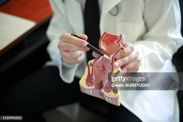 close up of doctor showing rectum model to patient - anal stock pictures, royalty-free photos & images