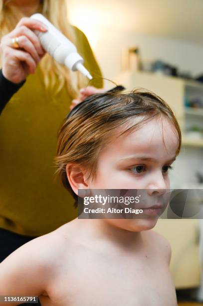 woman´s hand applying anti lice treatment with shampoo to little boy (6years) - シラミ ストックフォトと画像