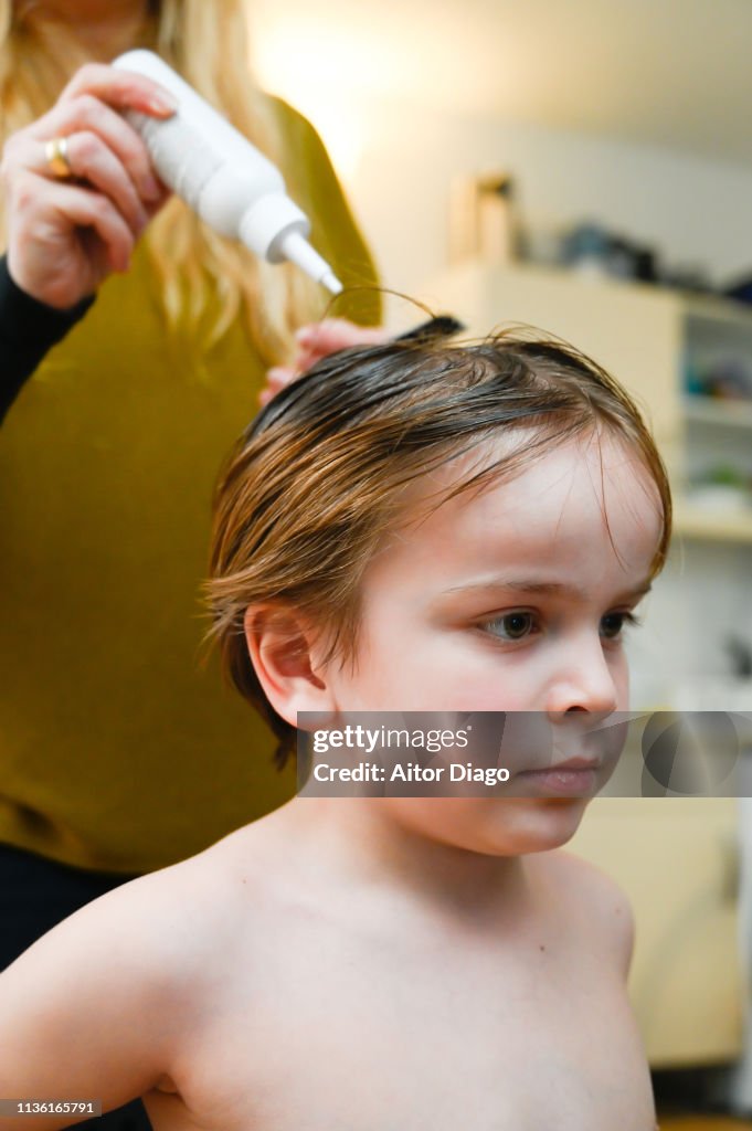 Woman´s hand applying anti lice treatment with shampoo to little boy (6years)