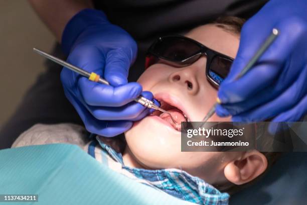 drie jaar oud kind met zijn open mond, terwijl tandarts werkt zijn tanden - fluor stockfoto's en -beelden