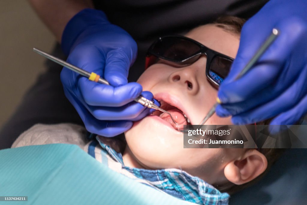 Three years old child with his open mouth while dentist works his teeth