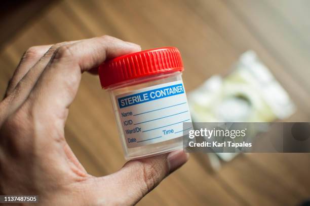 plastic urine collector and sterile bottle - baby pee stockfoto's en -beelden