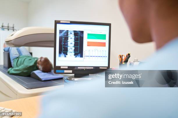 female nurse analyzing x-ray on computer monitor - osteoporosis stock pictures, royalty-free photos & images