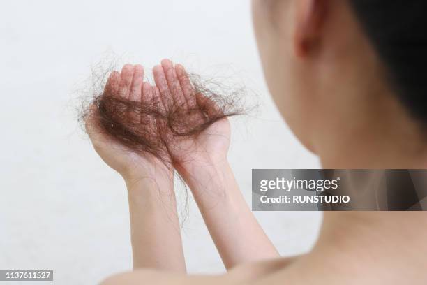 woman looking at loss hair - haaruitval stockfoto's en -beelden