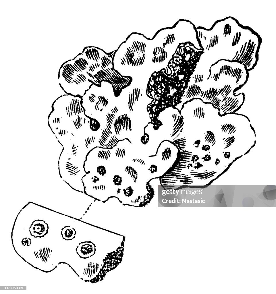 Lobaria scrobiculata, commonly known as the textured lungwort, is a large foliose, epiphytic lichen