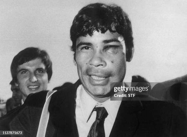 Le footballeur français d'origine argentine Nestor Combin rentre d'Argentine le visage tuméfié en octobre 1969, après avoir été agressé par le joueur...
