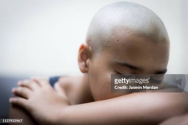 bald child - childhood cancer stock pictures, royalty-free photos & images