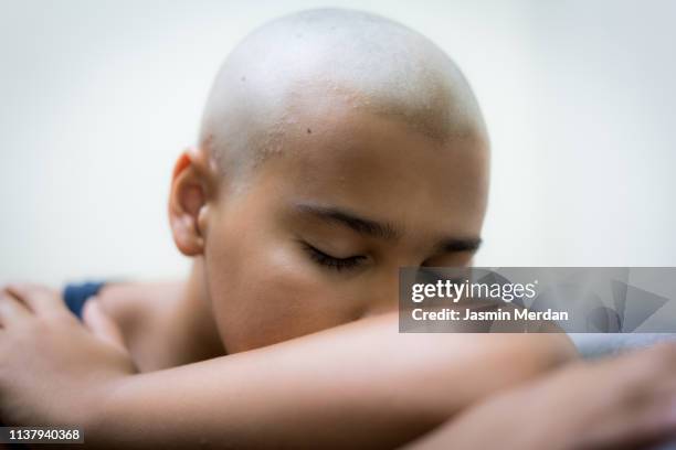 sick at home - bald child stock pictures, royalty-free photos & images