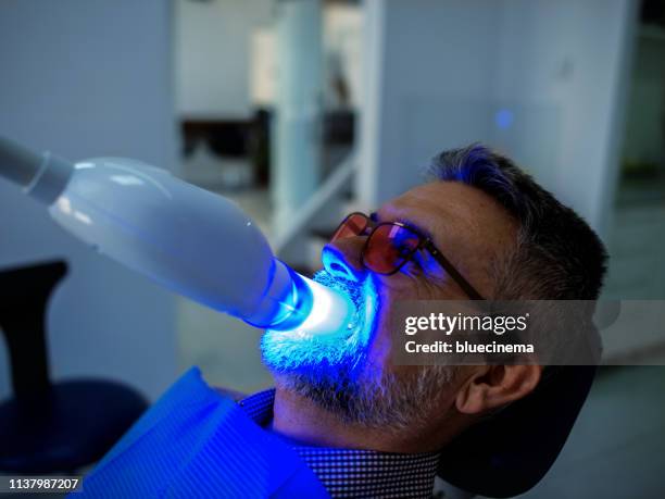 dentista odontoiatrico che lavora denti sbiancamento processo medico dentale - sbiancamento dentale foto e immagini stock