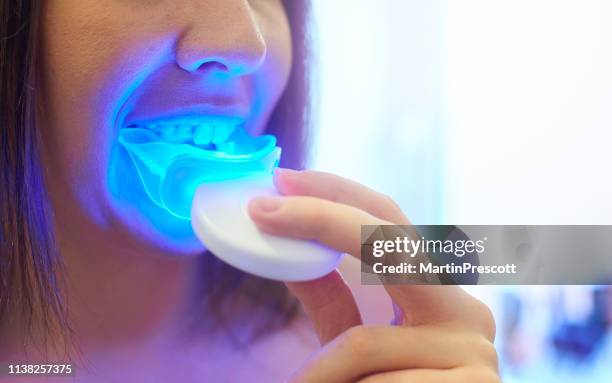 home teeth whitening - teeth whitening stock pictures, royalty-free photos & images