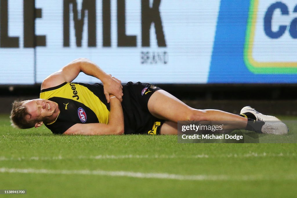 AFL Rd 2 - Richmond v Collingwood