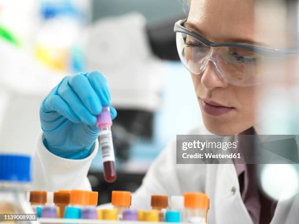 health screening, scientist holding a tube containing a blood sample ready for analysis in the laboratory - stem cell therapy stock pictures, royalty-free photos & images