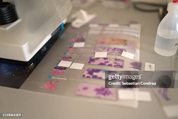 blood smear technique. hemoleucogram of hematology smear - pap smear 個照片及圖片檔