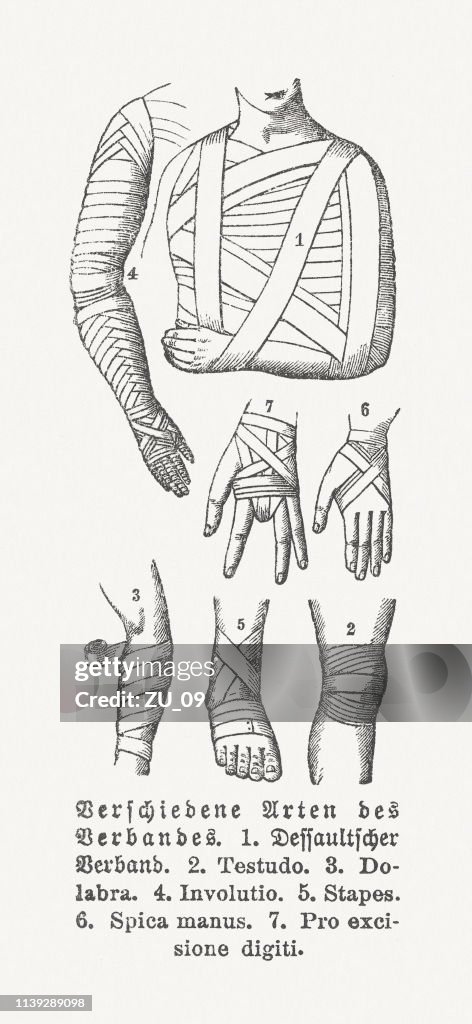 Different types of compression bandages, wood engravings, published in 1897