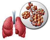 Lung Pulmonari Alveoli