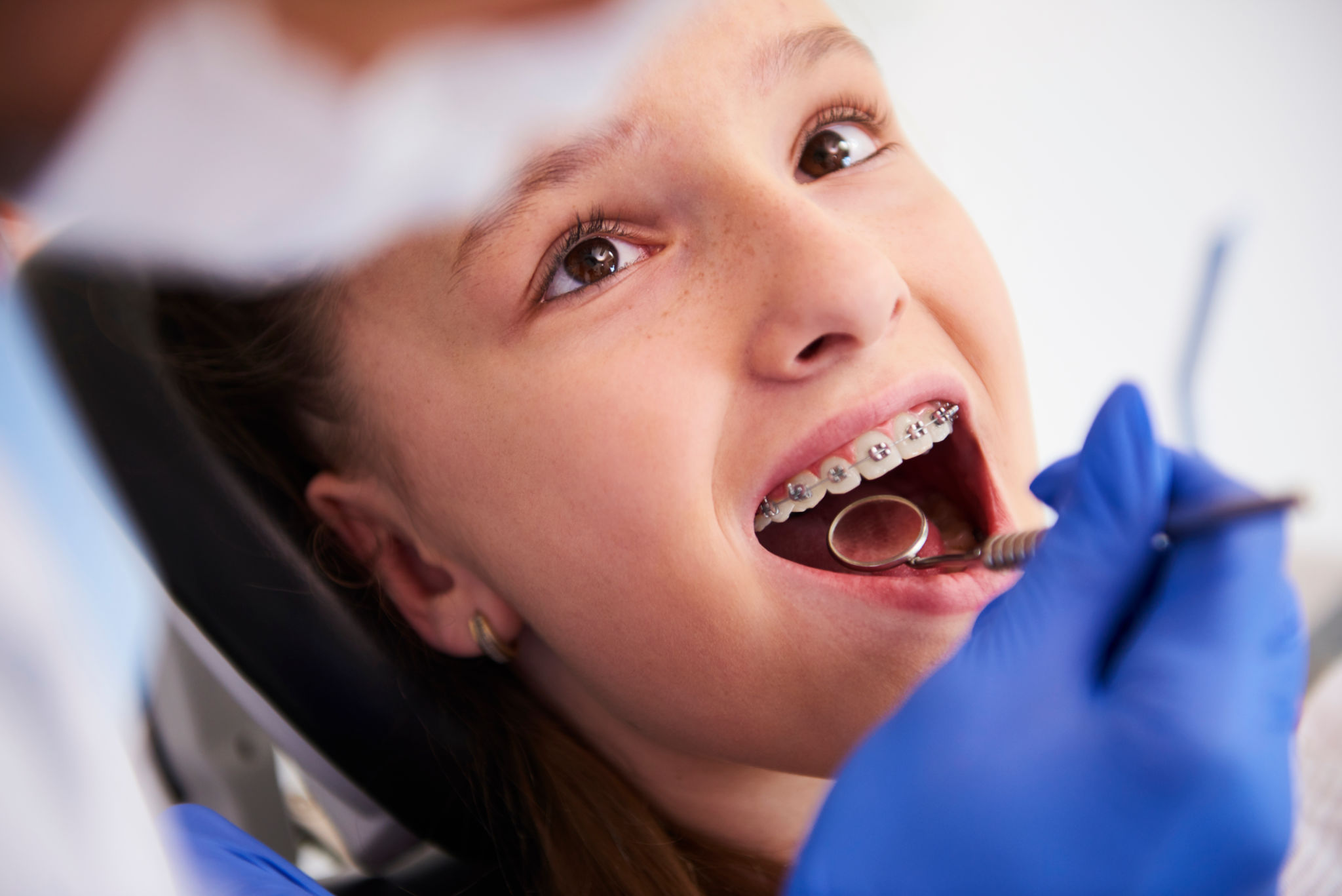 child orthodontics