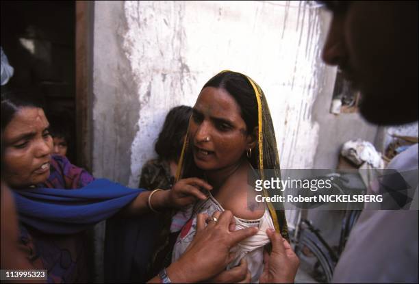 Illustration on conjugal violence disagreement of the DOT In India On May 31, 1995-Raj Bala showing wounds received by beating from her in-laws.