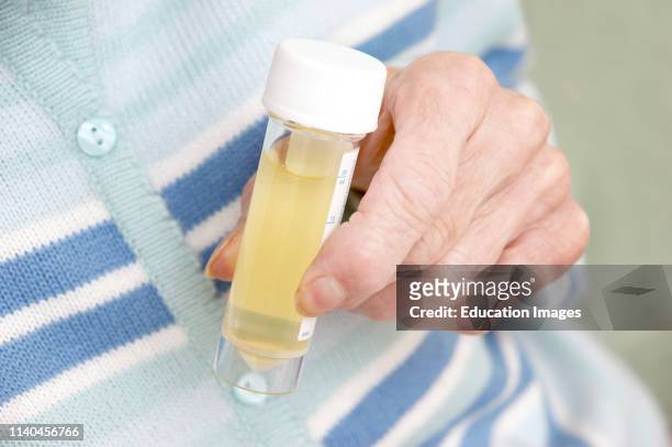Elderly woman with a sterile universal container with a urine specimen ready for analysis.