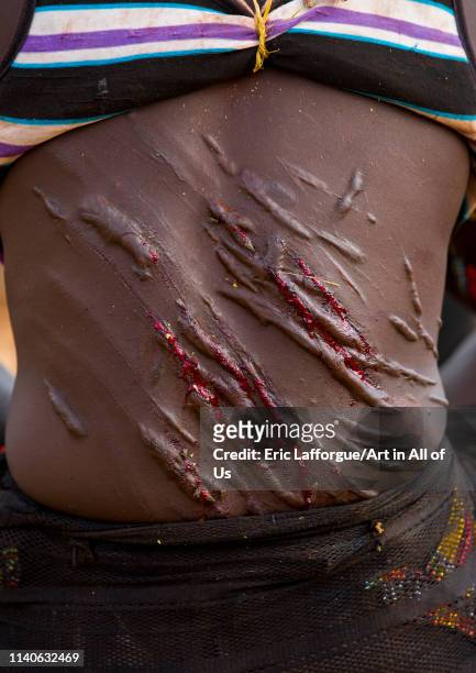 Bashada tribe woman scars during a bull jumping ceremony, Dimeka, Omo valley, Ethiopia"n on December 28, 2013 in Dimeka, Ethiopia.