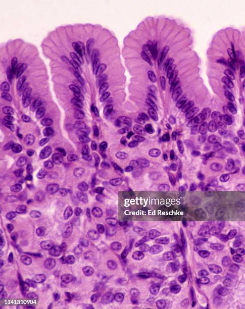 stomach (gastric) mucosa with simple columnar epithelium, 100x - darmschleimhaut stock-fotos und bilder