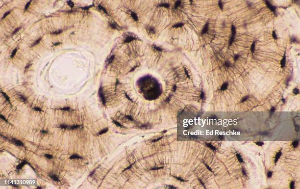 compact bone--haversian systems (or osteons) 100x - haversian system stock pictures, royalty-free photos & images