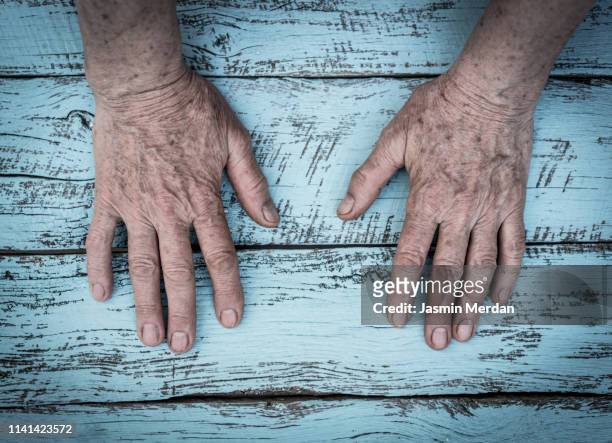 old wrinkled hands - rheumatism stock pictures, royalty-free photos & images
