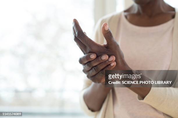 woman with hand pain - arthritis stockfoto's en -beelden
