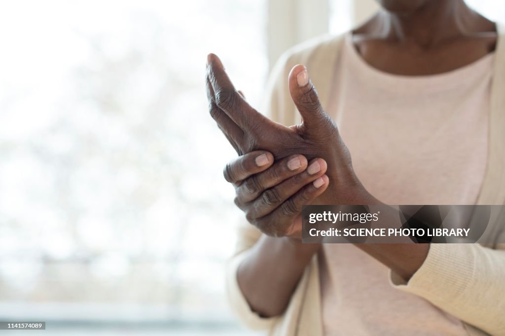 Woman with hand pain