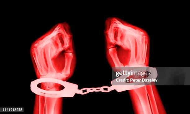 x-ray of hands with clenched fists in handcuffs - s & m ストックフォトと画像