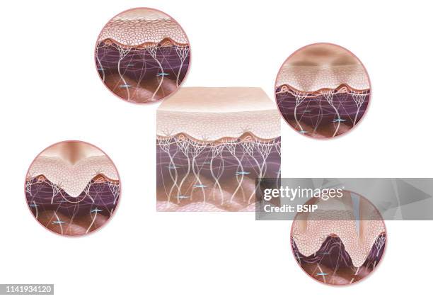 Illustration of the signs of ageing in skin, dulling of the epidermis, brown spots, skin slackening and wrinkles. In the centre of the image: a...