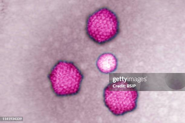 Adenovirus , responsible for: Colds, pharyngitis, bronchitis, pneumonia, gastroenteritis, conjunctivitis and keratitis. Image made from a...