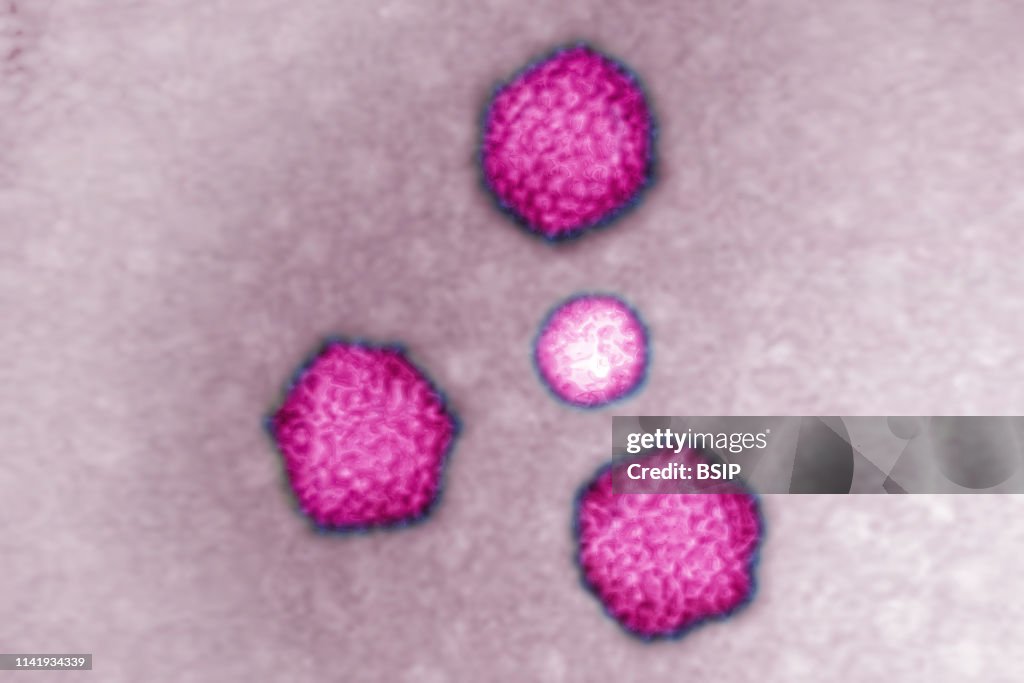 Adenovirus.