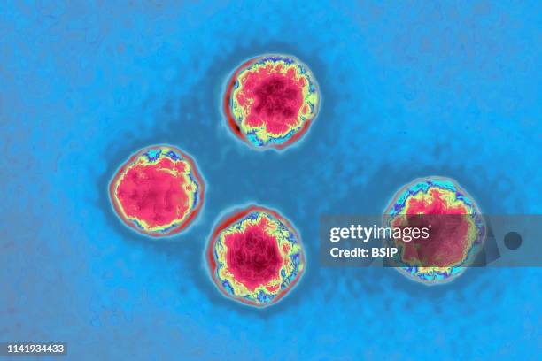 Picornavirus , responsible for: Colds, gastroenteritis, poliomyelitis and meningitis. Image made from a transmission electron microscopy view.