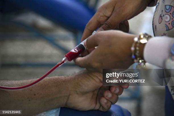 Patient suffering from renal failure receives hemodialysis treatment at a clinic in Barquisimeto, Venezuela, on April 24, 2019. - For cronic patients...