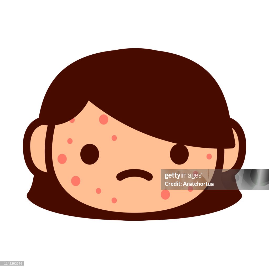 Cartoon Cute Emoji Character With Chicken Pox High-Res Vector Graphic -  Getty Images