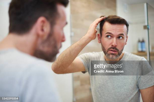 mature men is worried about hair loss. debica, poland - högt hårfäste bildbanksfoton och bilder