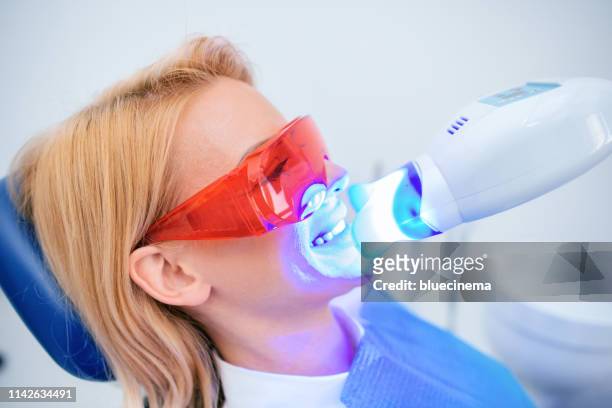 zahnärztin, die zahnersatz beschäftigt zahnaufhellung zahnarztpraxis - zahnaufhellung stock-fotos und bilder