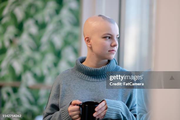 vrouw met kanker drinken - alopecia stockfoto's en -beelden