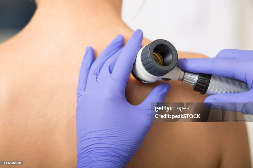 Dermatologist Inspecting patient skin moles at clinic