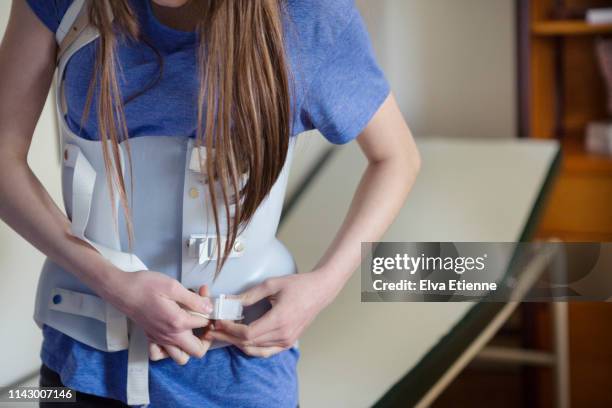 teenager fastening a back brace worn for scoliosis correction - orthopaedic equipment stock-fotos und bilder